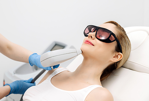 Laser Treatment to the Face