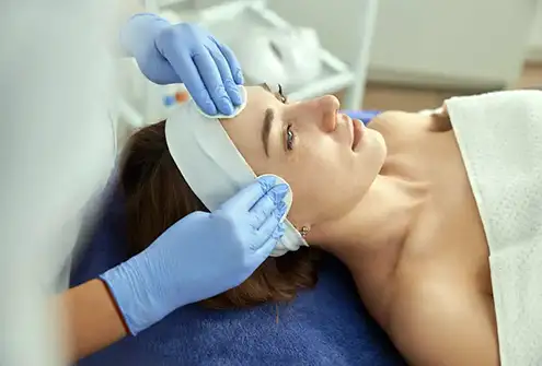 Client having a chemical Peels treatment